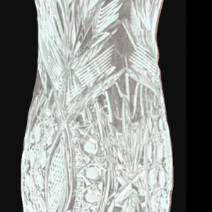 Detailed anatomical illustration of the human torso muscles and internal organs.